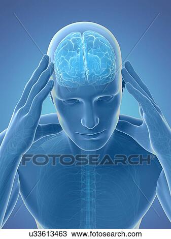 Headache, artwork View Large Illustration Drawing - Headache, artwork. Fotosearch