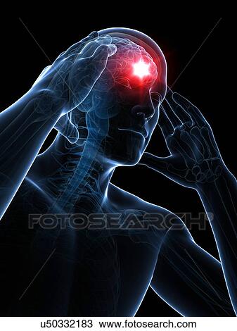Drawing - Headache, artwork. Fotosearch