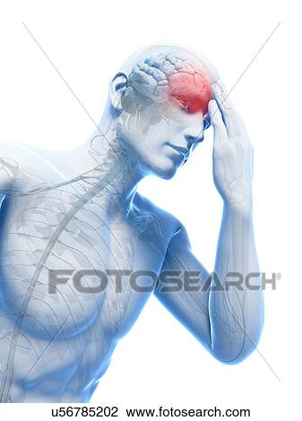 Headache, artwork View Large Illustration Drawing - Headache, artwork. Fotosearch