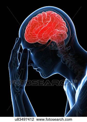Drawing - Headache, artwork. Fotosearch