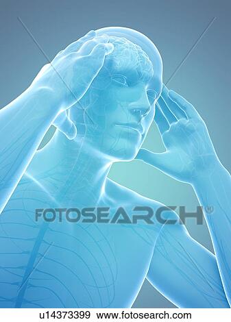 Stock Illustration - Headache, artwork. Fotosearch