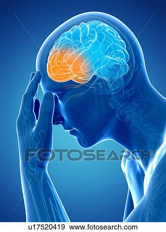 Headache, artwork View Large Illustration Stock Illustration - Headache, artwork. Fotosearch