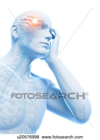 Stock Illustration - Headache, artwork. Fotosearch