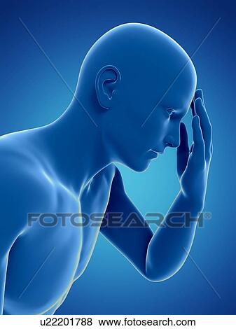 Stock Illustration - Headache, artwork. Fotosearch