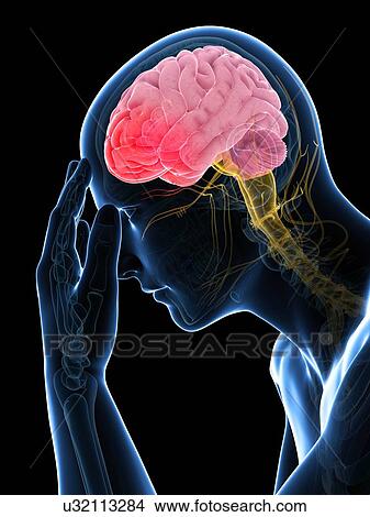 Stock Illustration - Headache, artwork. Fotosearch