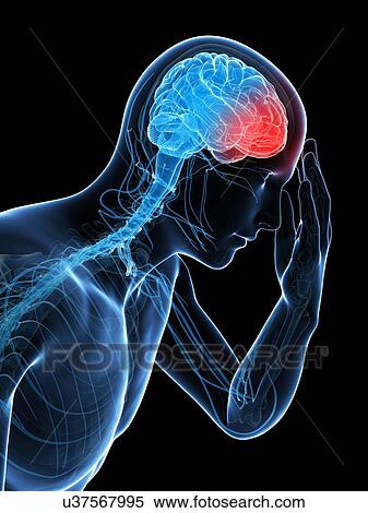 Stock Illustration - Headache, artwork. Fotosearch