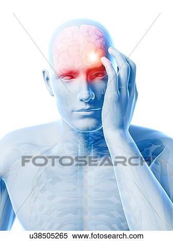 Headache, artwork View Large Illustration Stock Illustration - Headache, artwork. Fotosearch