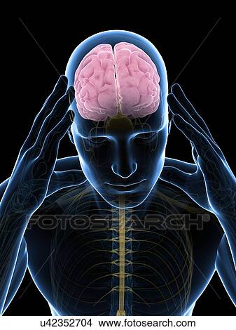 Headache, artwork View Large Illustration Stock Illustration - Headache, artwork. Fotosearch