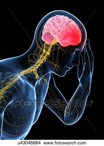 Headache, artwork View Large Illustration Stock Illustration - Headache, artwork. Fotosearch