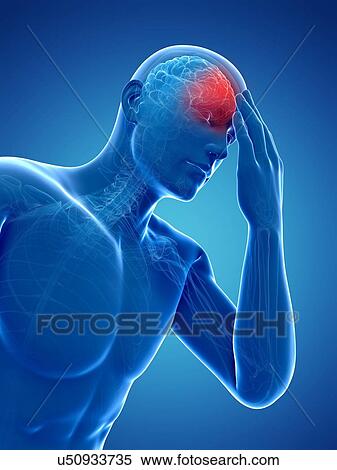 Stock Illustration - Headache, artwork. Fotosearch