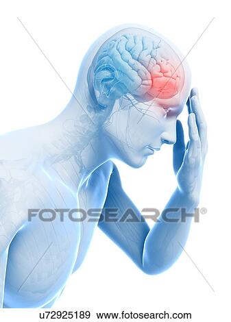 Stock Illustration - Headache, artwork. Fotosearch