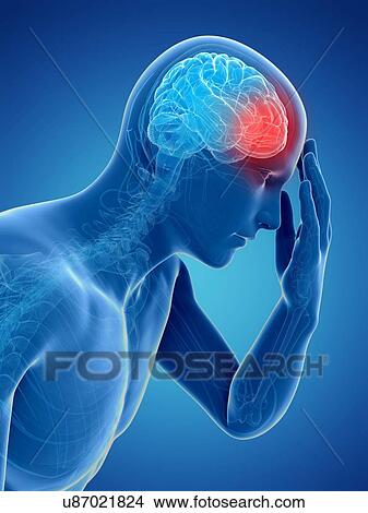 Stock Illustration - Headache, artwork. Fotosearch