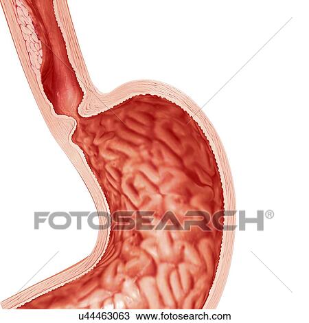 Drawing - Heartburn, artwork. Fotosearch