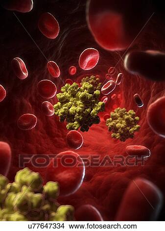 Hepatitis E virus, artwork View Large Illustration Stock Illustration - Hepatitis E virus, artwork. Fotosearch