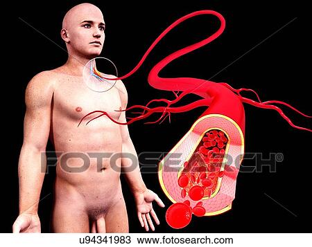 Human arteries, artwork View Large Illustration Drawing - Human arteries, artwork. Fotosearch