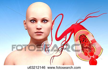 Human arteries, artwork View Large Illustration Stock Illustration - Human arteries, artwork. Fotosearch