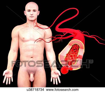 Human artery, artwork View Large Illustration Stock Illustration - Human artery, artwork. Fotosearch