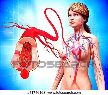 Human artery, artwork View Large Illustration Stock Illustration - Human artery, artwork. Fotosearch