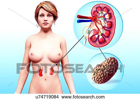 Human kidney stones, artwork View Large Illustration Stock Illustration - Human kidney stones, artwork. Fotosearch