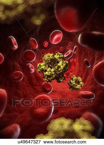 Stock Illustration - Human papillomavirus, artwork. Fotosearch