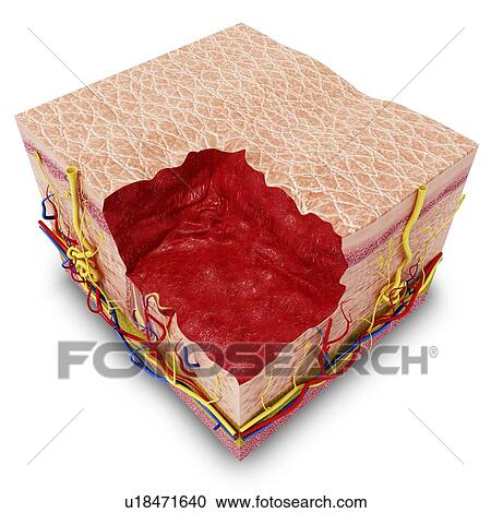 Clipart - Human skin anatomy, artwork. Fotosearch