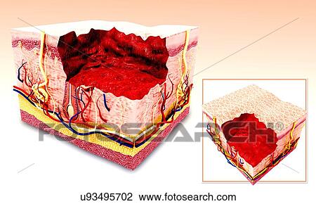 Drawing - Human skin anatomy, artwork. Fotosearch