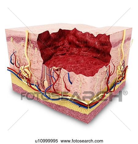 Stock Illustration - Human skin anatomy, artwork. Fotosearch