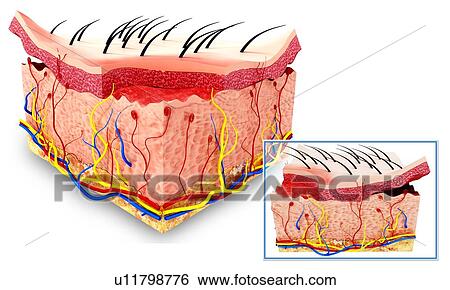 Stock Illustration - Human skin anatomy, artwork. Fotosearch