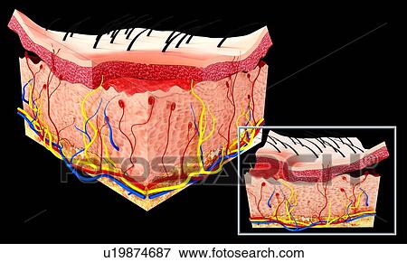 Human skin anatomy, artwork View Large Illustration Stock Illustration - Human skin anatomy, artwork. Fotosearch
