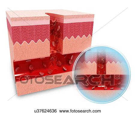 Human skin anatomy, artwork View Large Illustration Stock Illustration - Human skin anatomy, artwork. Fotosearch
