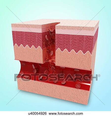 Human skin anatomy, artwork View Large Illustration Stock Illustration - Human skin anatomy, artwork. Fotosearch