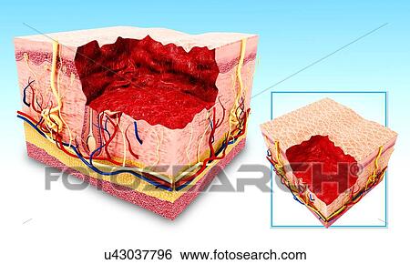 Human skin anatomy, artwork View Large Illustration Stock Illustration - Human skin anatomy, artwork. Fotosearch