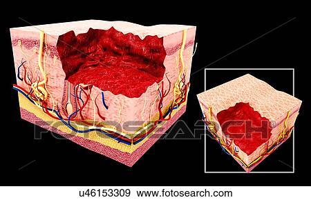 Stock Illustration - Human skin anatomy, artwork. Fotosearch