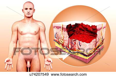 Human skin anatomy, artwork View Large Illustration Stock Illustration - Human skin anatomy, artwork. Fotosearch