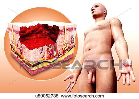 Human skin anatomy, artwork View Large Illustration Stock Illustration - Human skin anatomy, artwork. Fotosearch