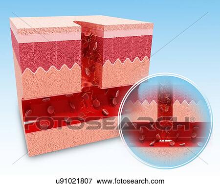Human skin anatomy, artwork View Large Illustration Stock Illustration - Human skin anatomy, artwork. Fotosearch