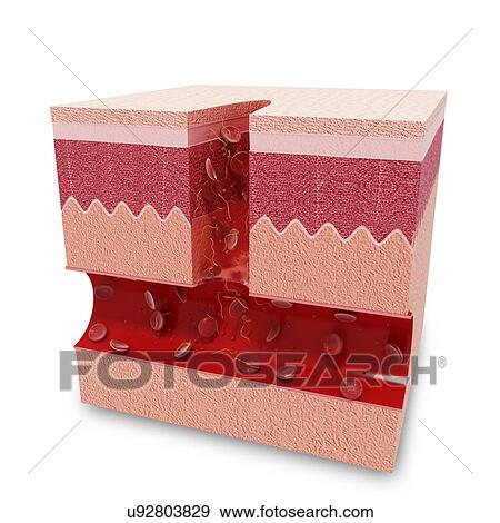 Human skin anatomy, artwork View Large Illustration Stock Illustration - Human skin anatomy, artwork. Fotosearch