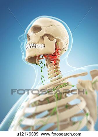 Stock Illustration - Inflamed lymph nodes, artwork. Fotosearch