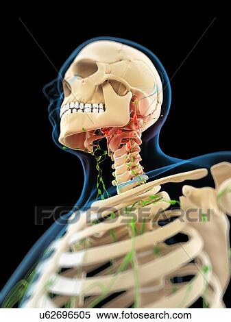 Inflamed lymph nodes, artwork View Large Illustration Stock Illustration - Inflamed lymph nodes, artwork. Fotosearch