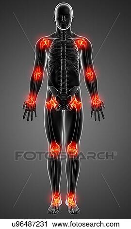 Joint pain, artwork View Large Illustration Clip Art - Joint pain, artwork. Fotosearch