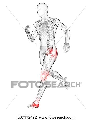 Joint pain, artwork View Large Illustration Drawing - Joint pain, artwork. Fotosearch