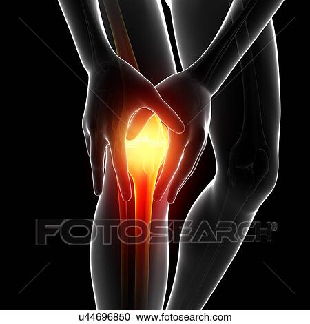 Knee pain, artwork View Large Illustration Clipart - Knee pain, artwork. Fotosearch