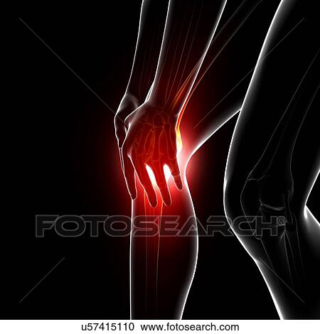 Knee pain, artwork View Large Illustration Clipart - Knee pain, artwork. Fotosearch