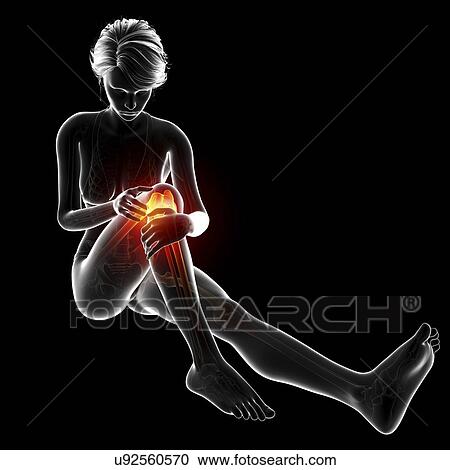 Knee pain, artwork View Large Illustration Clipart - Knee pain, artwork. Fotosearch
