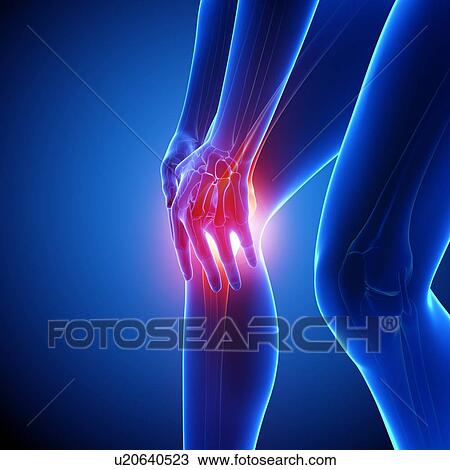 Drawing - Knee pain, artwork. Fotosearch