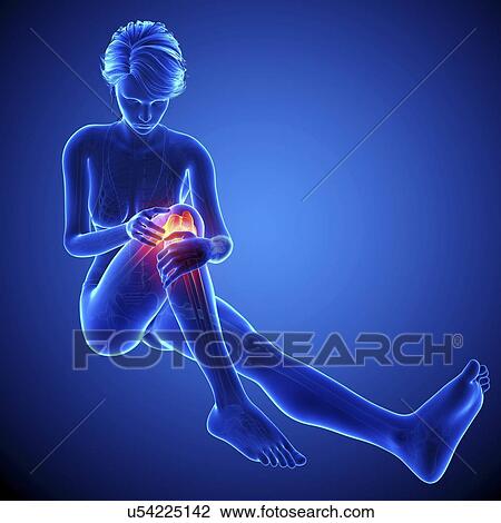 Drawing - Knee pain, artwork. Fotosearch