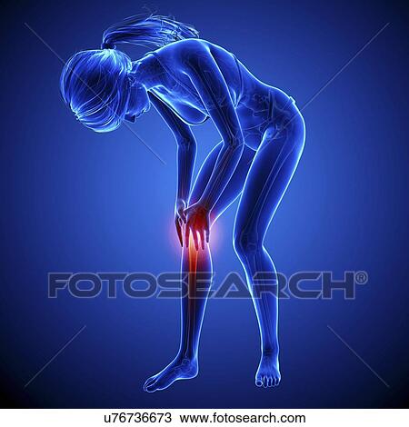 Knee pain, artwork View Large Illustration Drawing - Knee pain, artwork. Fotosearch