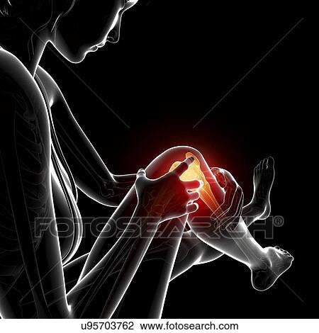 Knee pain, artwork View Large Illustration Drawing - Knee pain, artwork. Fotosearch
