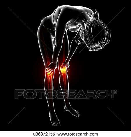 Knee pain, artwork View Large Illustration Stock Illustration - Knee pain, artwork. Fotosearch