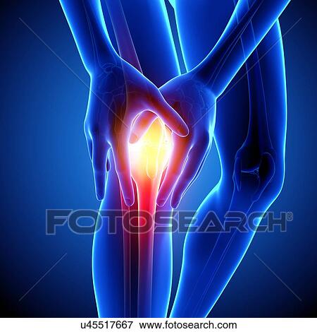 Knee pain, artwork View Large Illustration Stock Illustration - Knee pain, artwork. Fotosearch